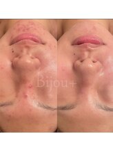 ビジュープラス ひたち野うしく店(Bijou+)/