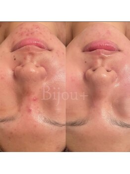 ビジュープラス ひたち野うしく店(Bijou+)/