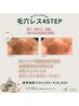 冬季限定！！毛穴特化の【毛穴レス美肌4STEP】￥24,100→