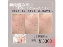 マヴィ くずは店(MavY.)/シミケア！夏前の今だからこそ