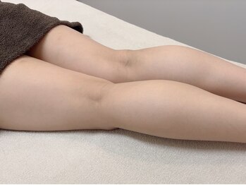 ブライダルベールトータルビューティ(BRIDAL VEIL total beauty)の写真/新機械導入!【ラジオ波＋EMS】リフトアップ機能とシェイプ機能がオートで切り替わりフェイス＆ボディ可能◎