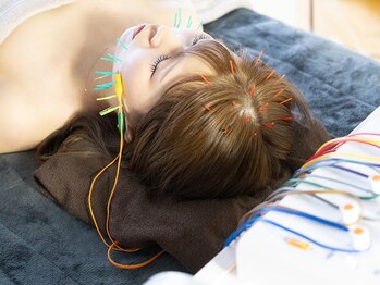 ラムールボーテ(L'AMOUR BEAUTE)の写真/キレイな人はやっている!女性鍼灸師によるオーダメイド美容鍼で肌質改善/小顔ケア◎鍼初心者の方も大歓迎☆