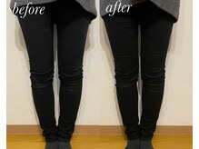 ベルバーチュプラス(Belle Virtue +)/インナーインパクト