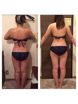 ビーシェイプ 君津(B-Shape)/【痩身】ビフォーアフター