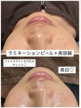 陽月 鍼灸院整骨院/口元美人♪