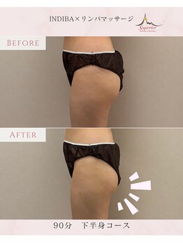 スーペリオル(Superior)/キレイなヒップラインに!