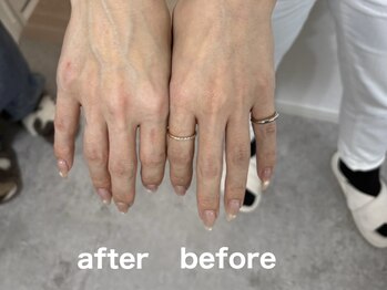 ボヌール(Bonheur)/#パラフィンパック