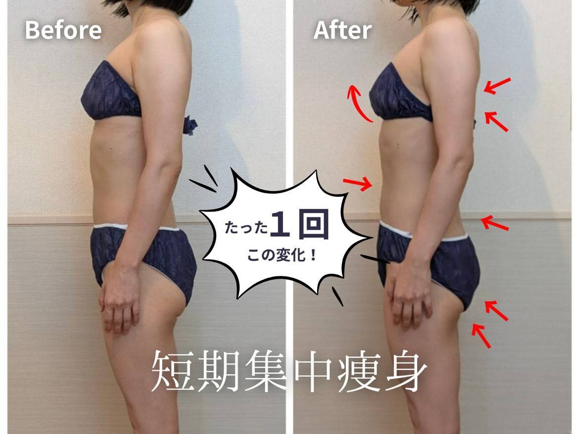 栃木市でダイエットが人気のエステサロン｜ホットペッパービューティー