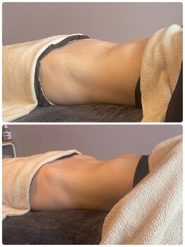 ティエルプラス(tiele+)/骨盤調整×HOT腸もみ