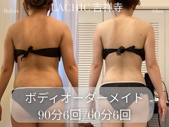 ラシク 吉祥寺(LACHIC)/背中、腰周りすっきり！