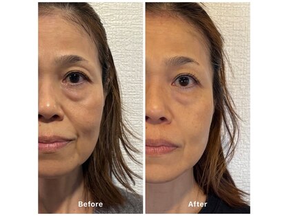 エクレクティック(ECLECTIC)の写真