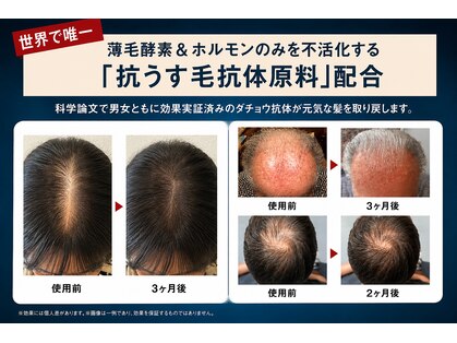 アミティ プラス(amity plus)の写真