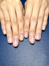 深爪でお悩みの方