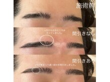 フー 広島(Fuu)/＊