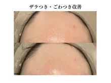 リノ(Lino)/ざらつき・ごわつき改善