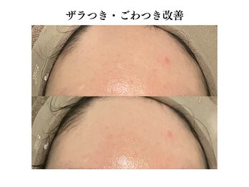 リノ(Lino)/ざらつき・ごわつき改善