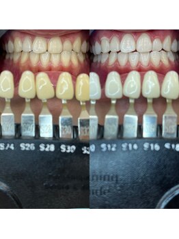トウキョウスワーズ 池袋店(TOKYO SWRS)/#ホワイトニング #池袋 #渋谷