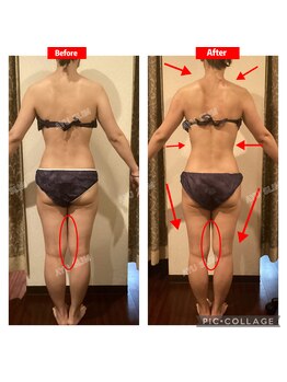 アユスリム(AYU SLIM)/一回でも変化できるの充実痩身!