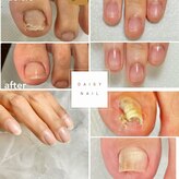 デイジーネイル(Daisy Nail)