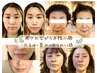 【美肌人気No.1】癒しの小顔矯正＋ヘッド＆デコルテ70分12,000→7,700