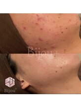 ビジュープラス ひたち野うしく店(Bijou+)/