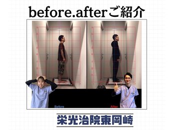 栄光治院 整体院東岡崎/岡崎/東岡崎/整体/腰痛/肩こり