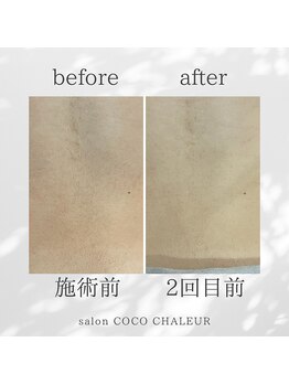 ココ シャルール(salon COCO CHALEUR)/Before　After