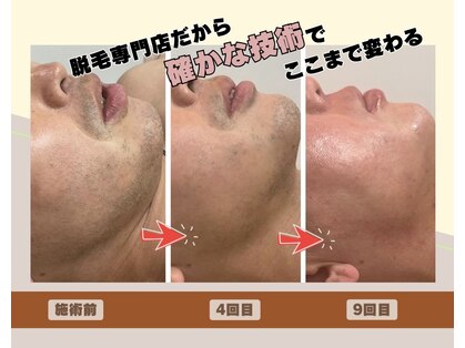 フォー(the 4)の写真