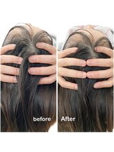 ニコディア(nico-dia)/小顔矯正