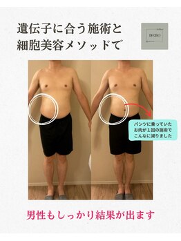 エーシーサロン 六本木店(acsalon)/ぽっこりお腹はお任せください♪