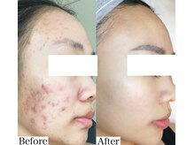 エム 銀座(M)の雰囲気（神業！小顔最高峰技術！ハーブピーリング/ハーブピーリング小顔）