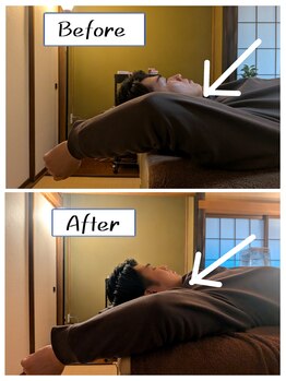 スラープ バイ はりきゅう院米山(slaap)/肩甲骨 単発¥3,400/組合せ¥2,400