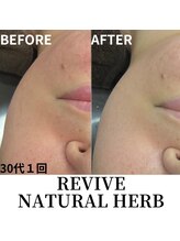 ベラドンナ(Bella Donna)/ハーブフェイシャル