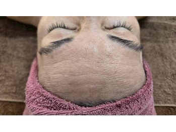 クレビア(CREBIA)/【シミ・シミケア専門店】沖縄県