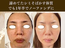 エミフル(emifull)/何をしても変わらないと思ってた