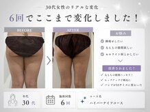 ミヨンラボ(miyon LABO)