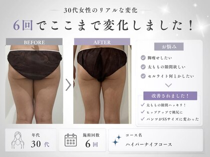 ミヨンラボ(miyon LABO)の写真