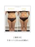 【最速で別人級変化】】1回でマイナス20cmの実績☆全身ボディエステ体験