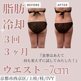 アイビー(IVY)