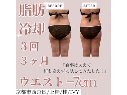 アイビー(IVY)の写真