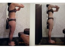 パーフェクトボディプレミアム 名古屋駅前店(PERFECT BODY PREMIUM)/お客様　ビフォーアフター（16）