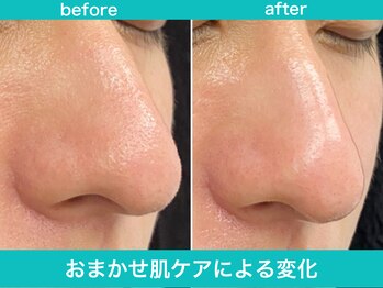 ミスターアンクール 鹿児島(Mr.uncoeur)/おまかせ肌ケア