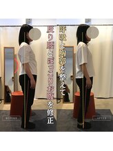 岡山整体 リソル(Resol)/反り腰｜ぽっこりお腹