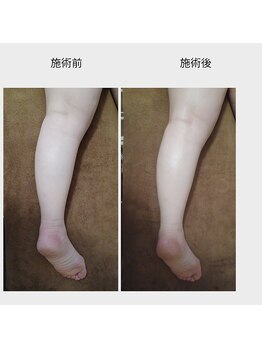 クレール(clair)/足のだるさも痩身マシンで解消！