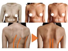 エミュボディ 青山本店(emu body)/バストアップ写真　乳房リリース