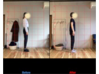 デップ 長野松本店Noah(DEP)/2ヶ月の姿勢変化