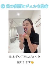 ホワイトニングショップ 柏店/(5)歯の表面にジェルを塗布