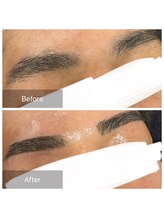 ダンニヒル(dannihil)/【眉ワックス】【VIO脱毛】