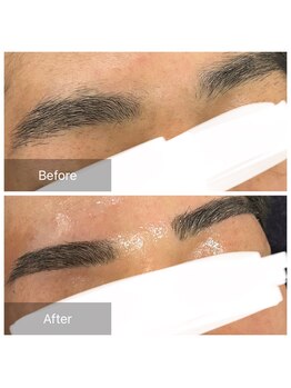 ダンニヒル(dannihil)/【眉ワックス】【VIO脱毛】