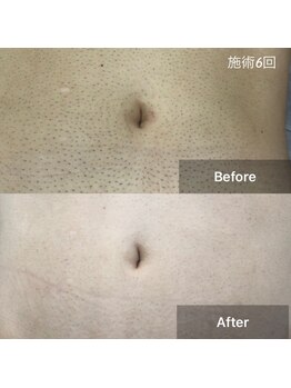 ラフルール(LA FLEUR)/